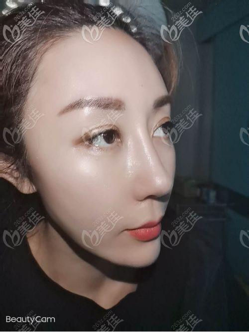 国产膨体材料视频,创新突破，引领医疗美容新篇章